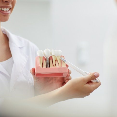 Dentist using model to explain dental implant model