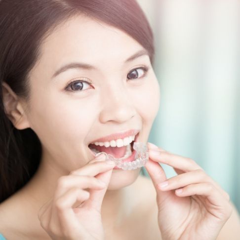 Woman placing a Sure Smile aligner tray