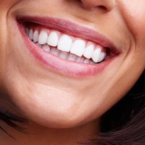 Closeup of smile after teeth whitening