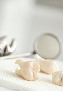 a patient holding her cheek due to tooth pain