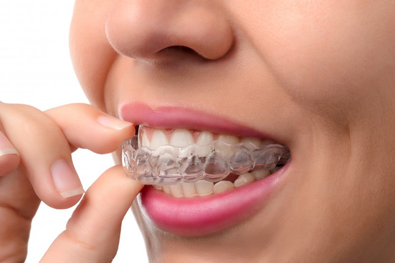 woman putting on her Invisalign tray